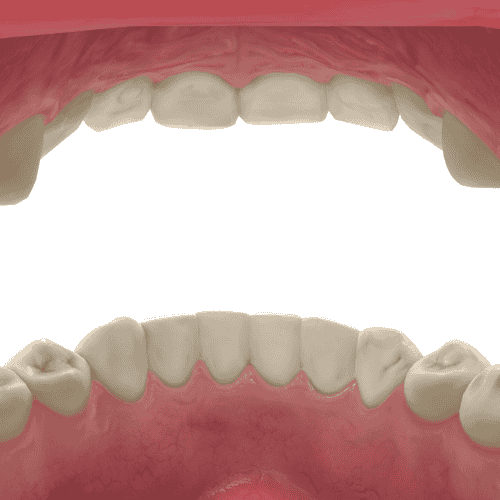 Effective Package for Dental Crown in Medellin, Colombia