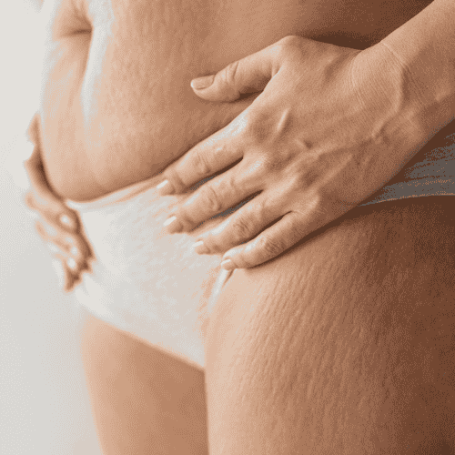 Gastric Bypass Package by Costamed in Cancun, Mexico