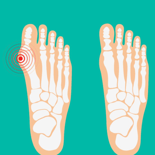 Premium Stem Cell Therapy for Osteoarthritis in Tijuana, Mexico