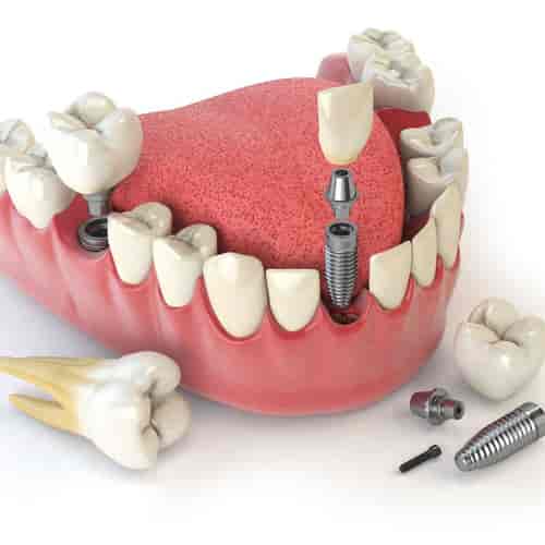 Quality International Dental Clinic