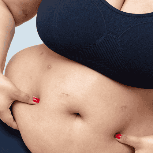 Laparoscopic Gall Bladder Removal
