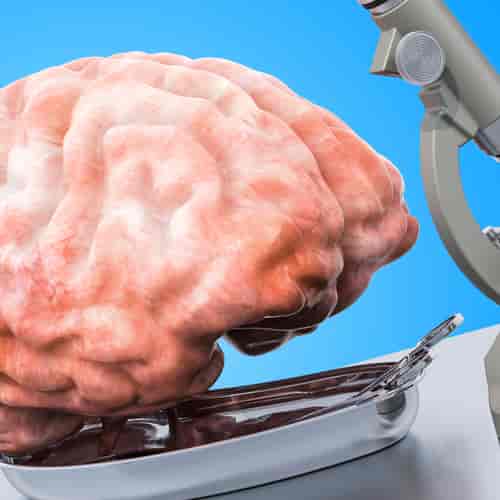 Stem Cell Therapy for Parkinson’s Disease Package in Monterrey, Mexico by Stem Solutions