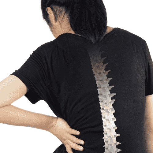 Stem Cell Therapy for Spine Arthritis Package in Guadalajara, Mexico by Instituto de Terapia Celular