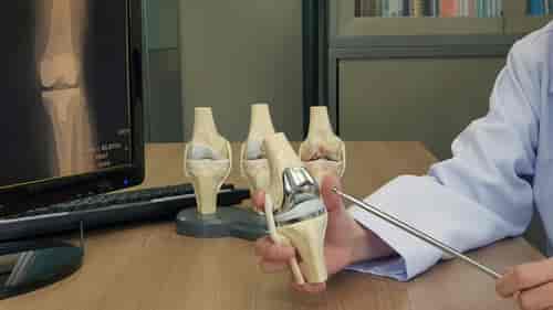  Total Knee Replacement (TKR) Treatment Package
