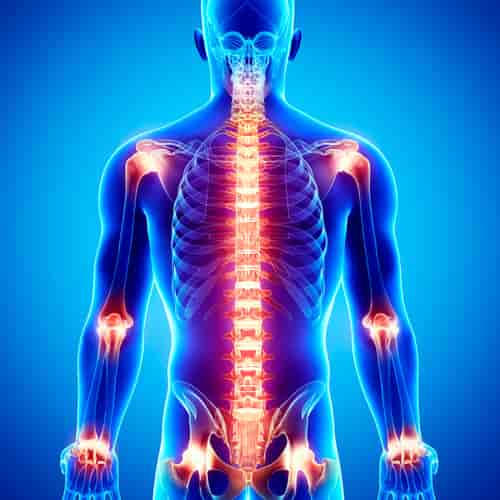 Stem Cell Therapy for Joint Inflammation in Santo Domingo- $4,400