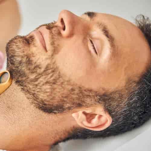Beard Transplant Package – Up to 500 Grafts