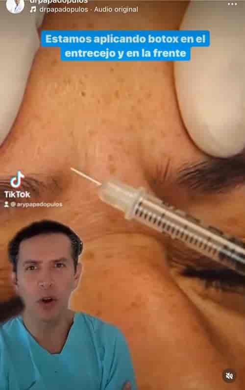 Botox Package at Dr. Ary Papadopulos - Plastic Surgery in Mexico City, Mexico City, Mexico