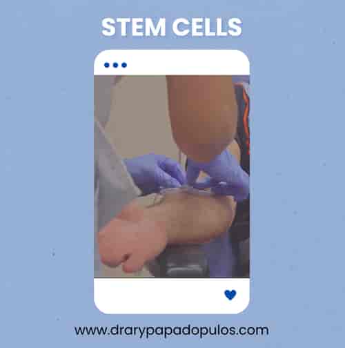 Stem Cell Treatments for Anti Aging Mexico Package by Dr. Papadopulos in Mexico City