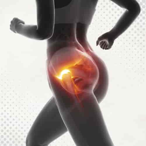 Stem Cell Therapy for Hip Osteoarthritis Package in San Jose del Cabo, Mexico by Longevity Medical Institute®