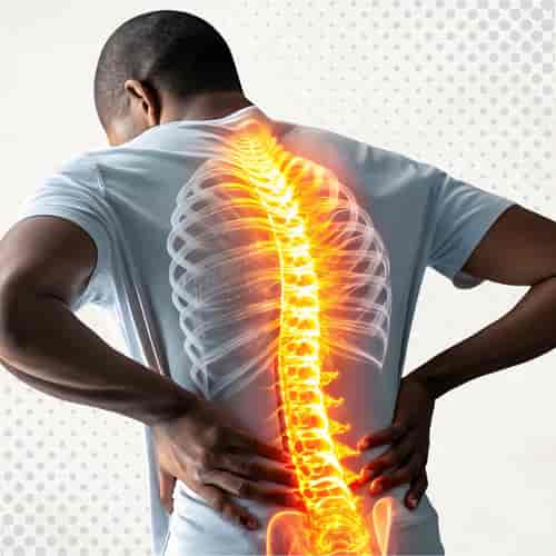 Stem Cell Therapy for Spinal Disc Degeneration Package in San Jose del Cabo, Mexico by Longevity Medical Institute®