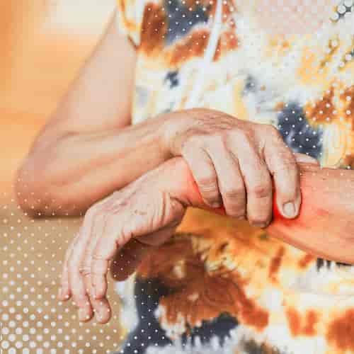 Stem Cell Therapy for Lupus & Autoimmune Disease Package in Kuala Lumpur, Malaysia by FirstCell