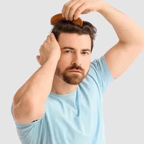 Transformative FUE Hair Transplantation Package in Istanbul, Turkey