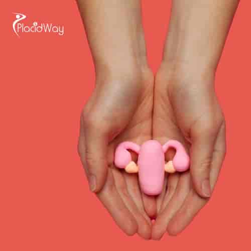 Alternative Ovarian Cancer Treatment Package in Tijuana, Mexico by ITC