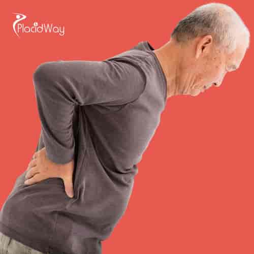 Alternative Anal Cancer Treatment Package in Tijuana, Mexico by ITC