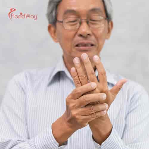 Stem Cell Therapy for Rheumatoid Arthritis in Mexico City, Mexico