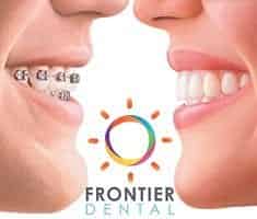 Frontier Dental
