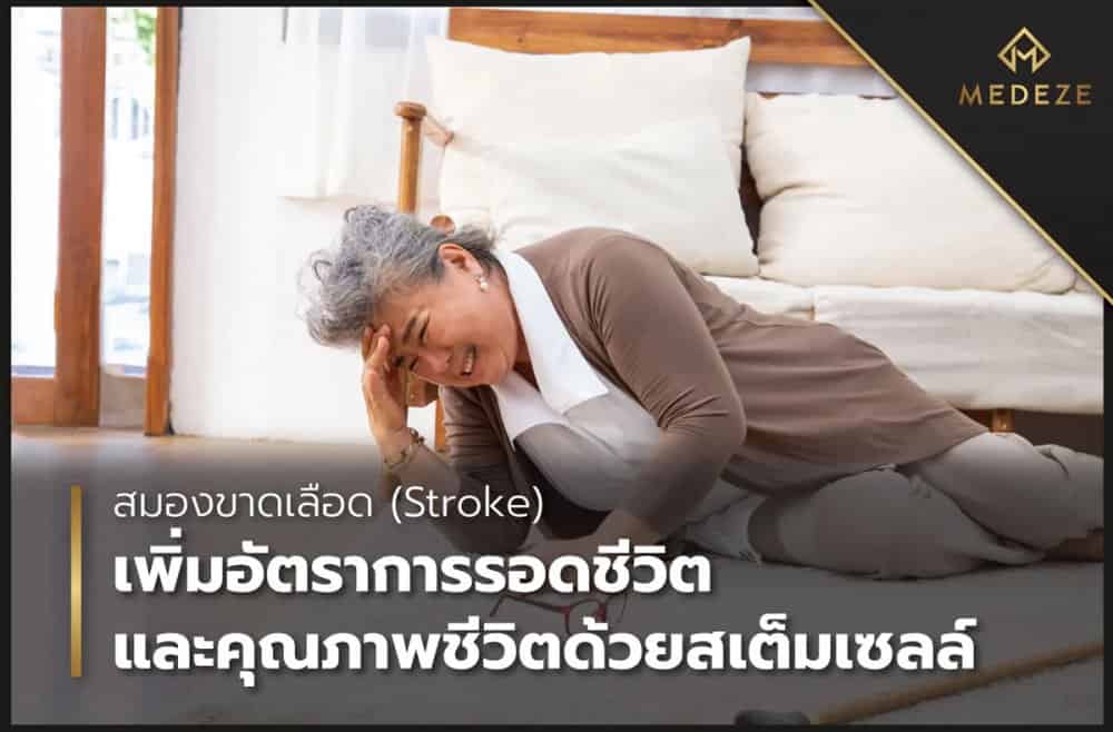 Stem Cell - Anti Aging Therapy