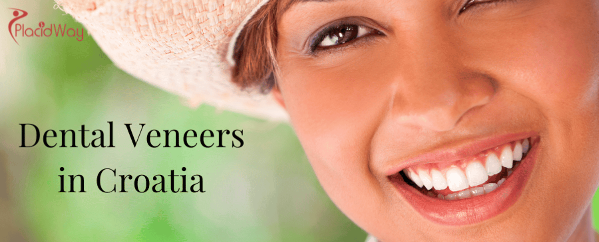 Carillas dentales en Croacia