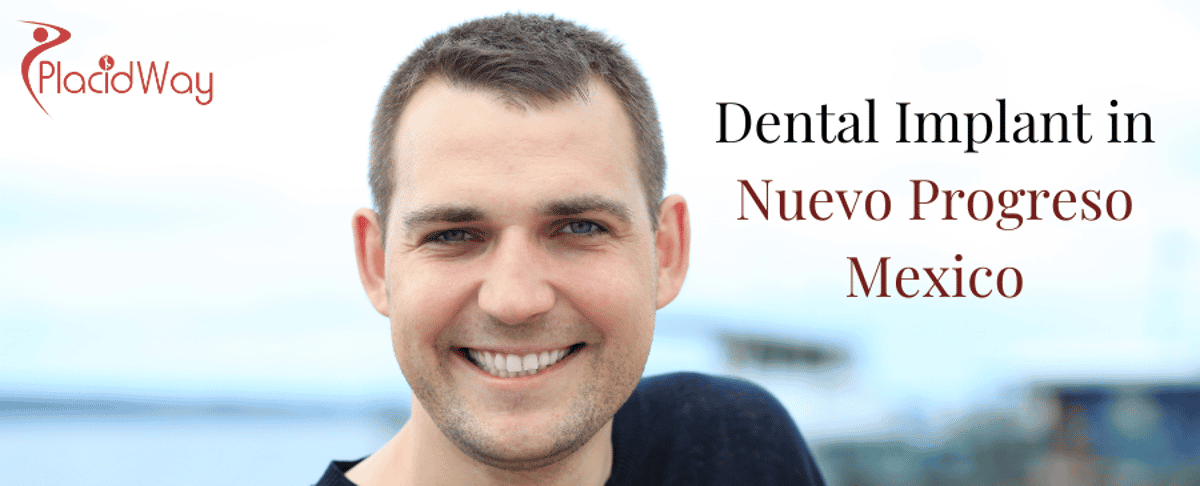 Implante Dental en Nuevo Progreso México