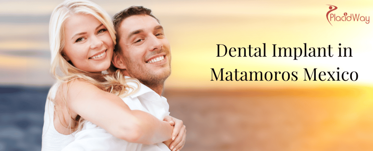 Implantes dentales en Matamoros, México