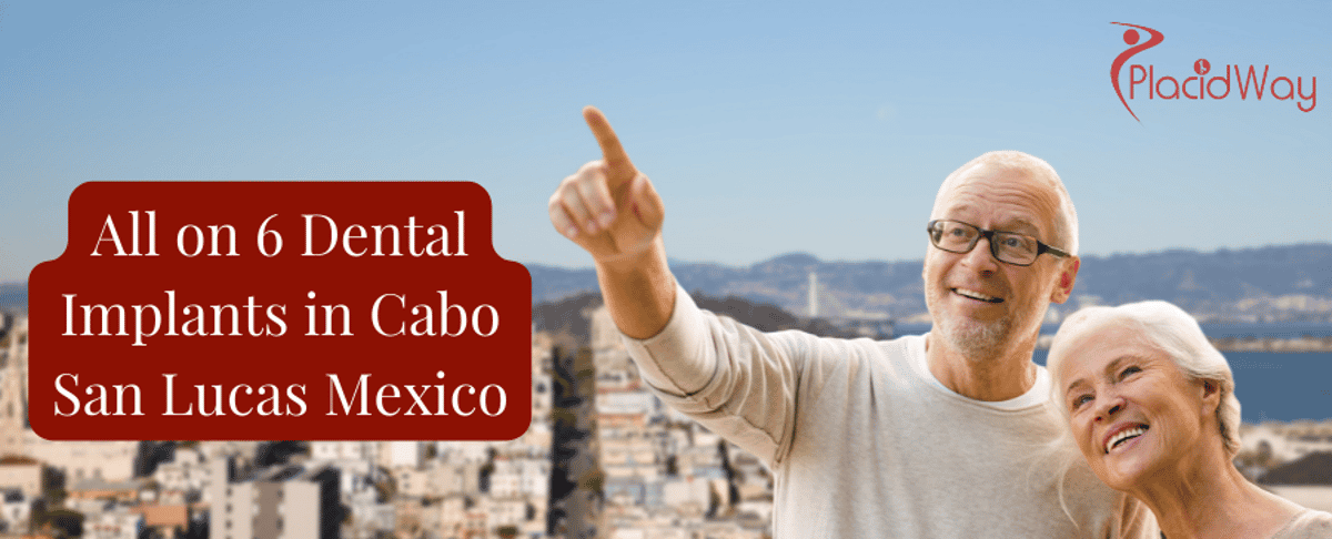 Implantes dentales All on 6 en Cabo San Lucas México