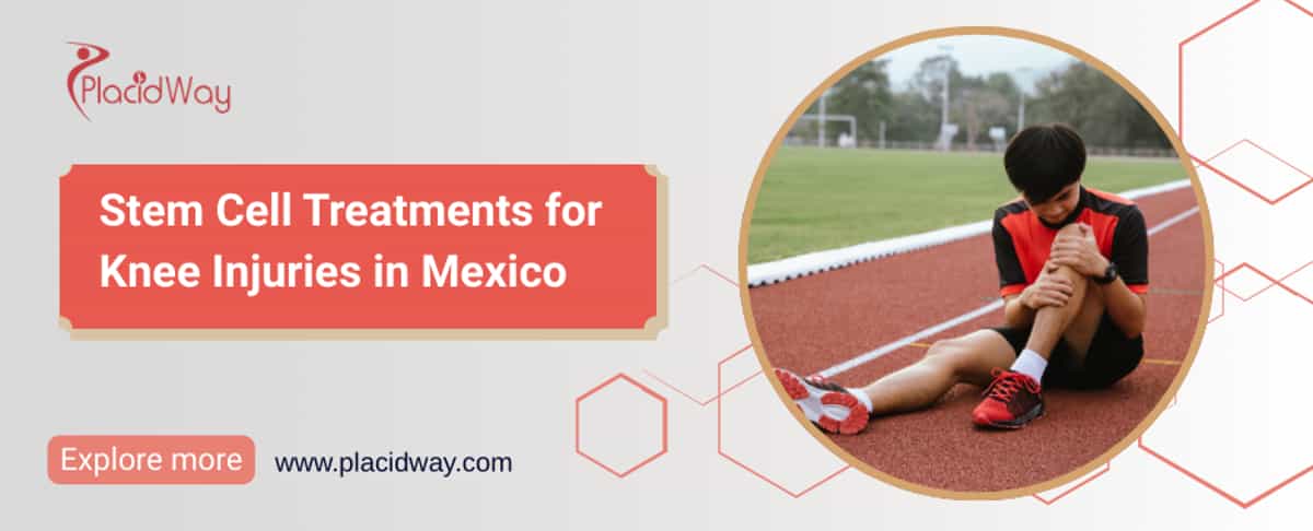 Terapia con células madre para la rodilla en México