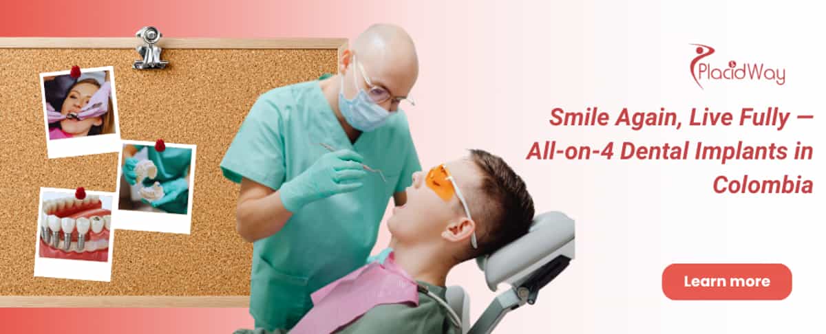 Implantes dentales All on 4 en Colombia
