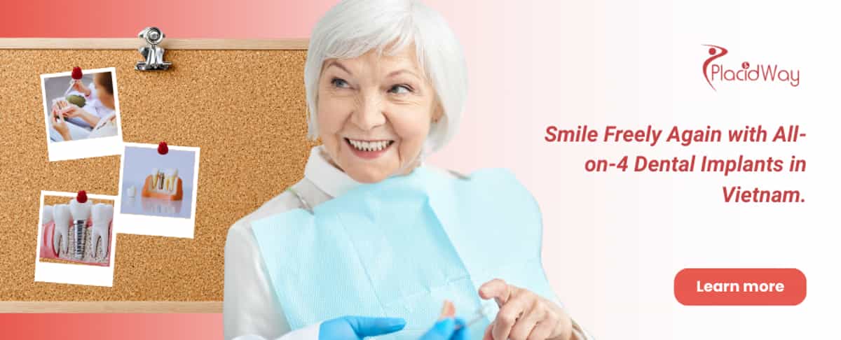 All-on-4 Dental Implants in Vietnam