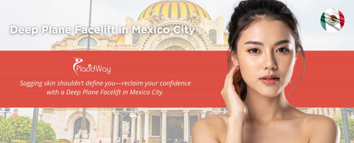 Deep Plane Facelift in Mexico City, Mexico