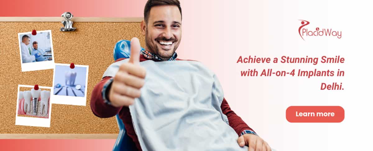 All on 4 Dental Implants in Delhi - Get Perfect Smile