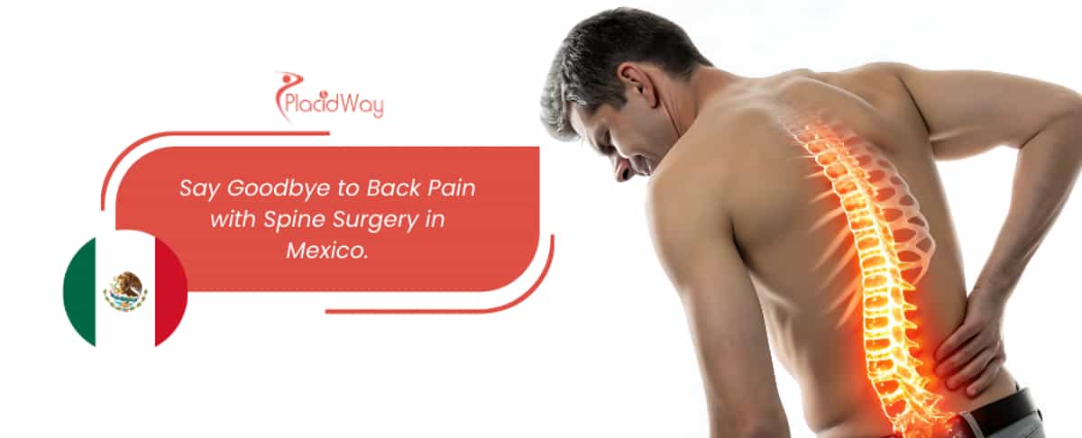 Spine Surgery in Mexico - Your Relief from Back Pain!