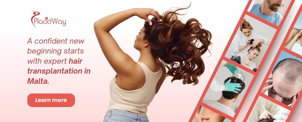 Haartransplantation in Malta