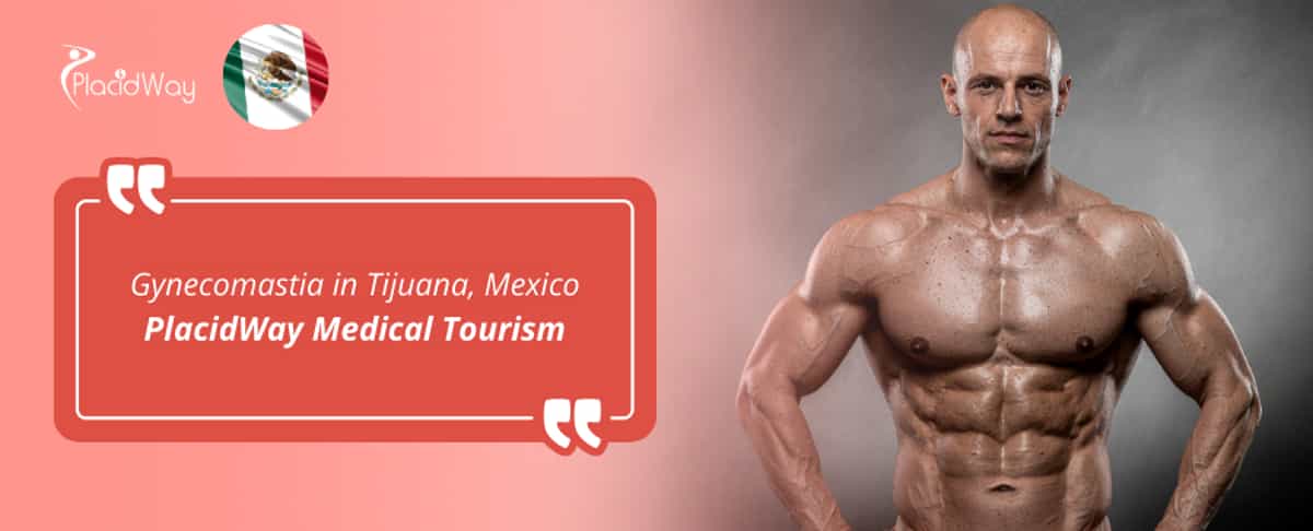 Gynecomastia in Tijuana, Mexico