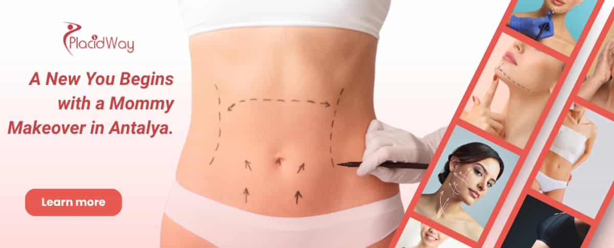 عملية تجميل الأم في أنطاليا، تركيا