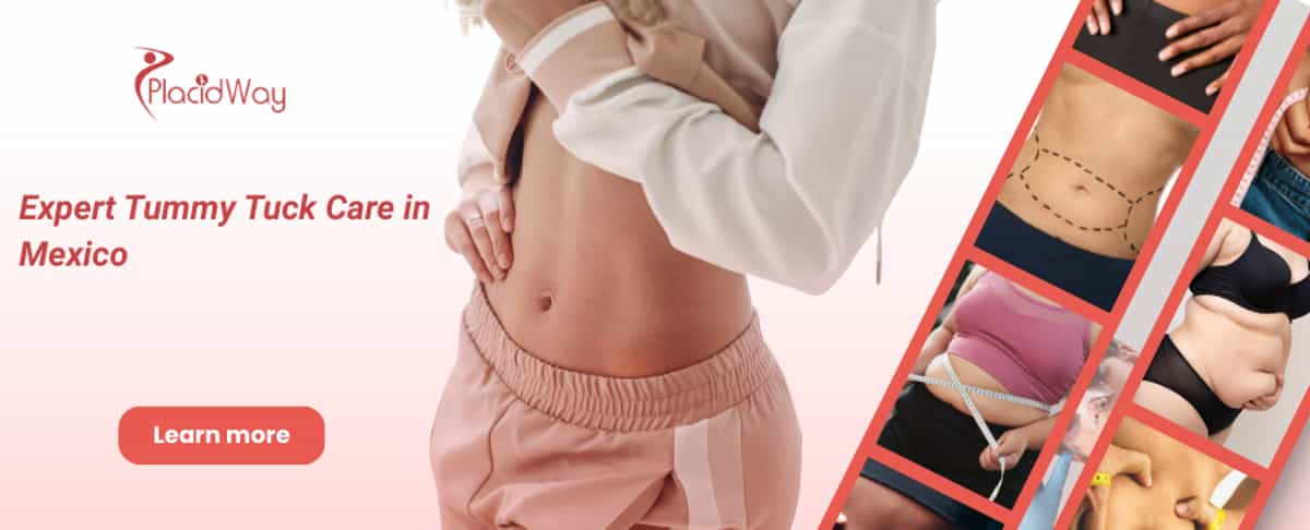 Abdominoplastia en Tijuana México – ¡Mejora la forma de tu cuerpo!
