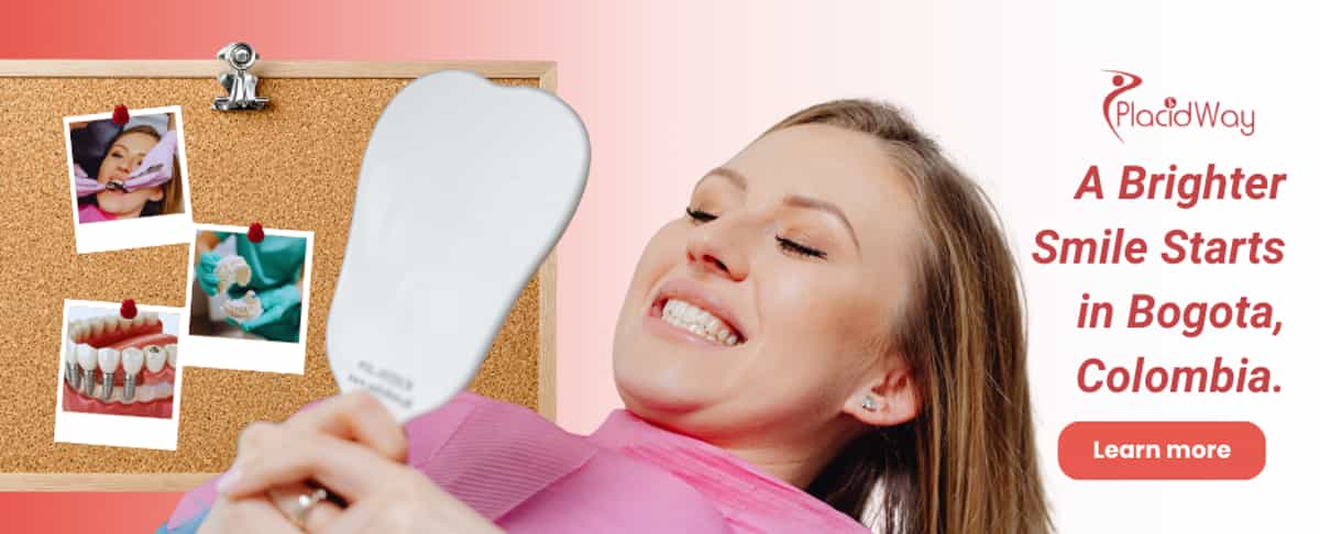 Dental Veneers in Bogota Colombia
