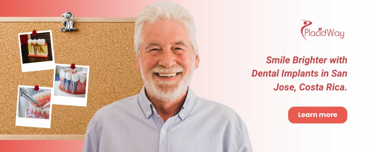 Implantes dentales en San José, Costa Rica