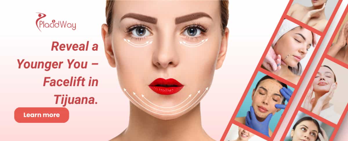 Rejuvenecimiento facial en Tijuana, México