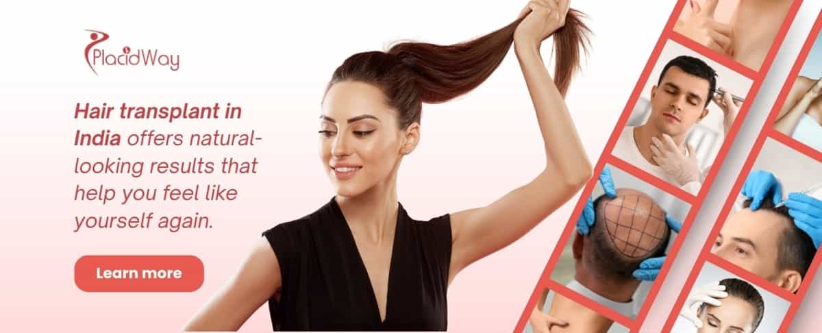 زراعة الشعر في الهند