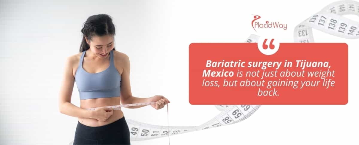 Cirugía Bariátrica en Tijuana, México
