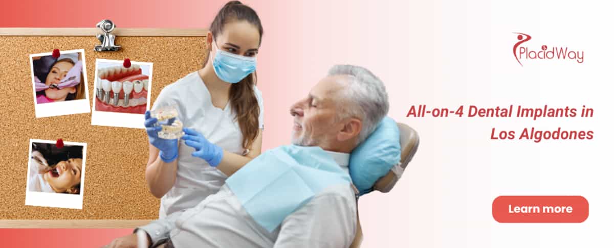 Todo sobre 4 Implantes Dentales en Los Algodones, México 