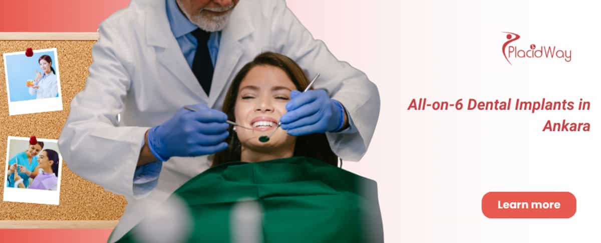 All-on-6 Implants Ankara, Turkey