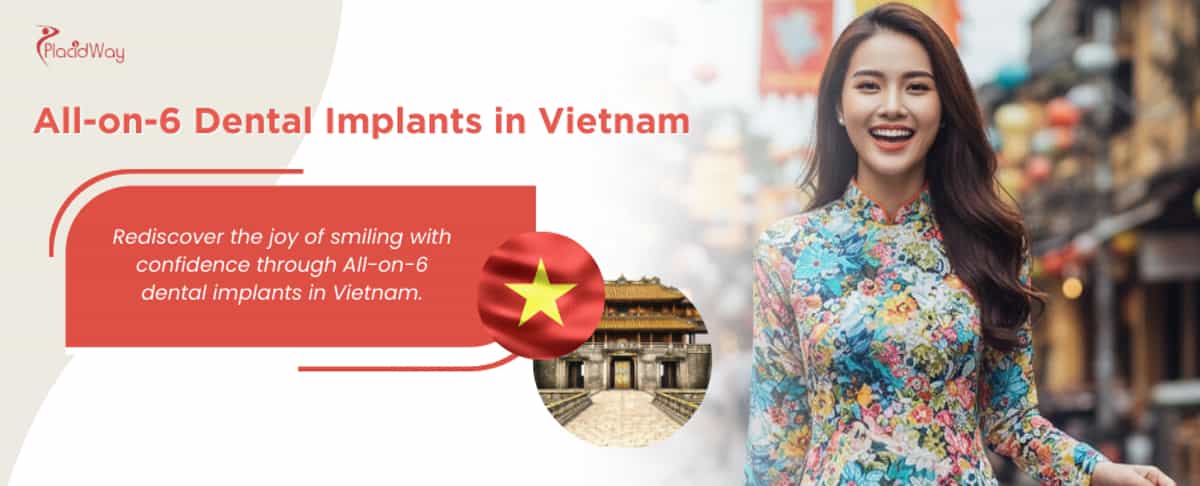 All-on-6 Dental Implants in Vietnam