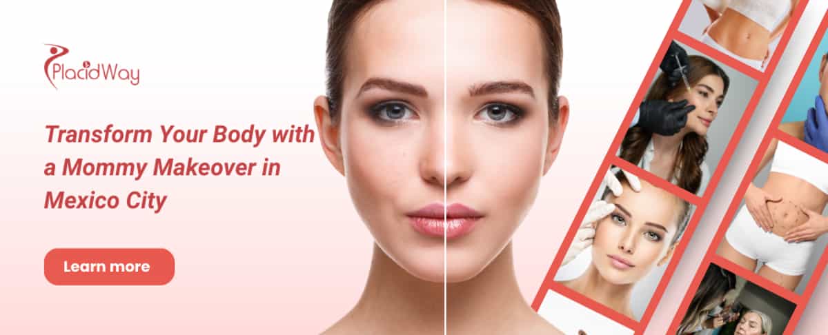 Mommy Makeover en la Ciudad de México, México