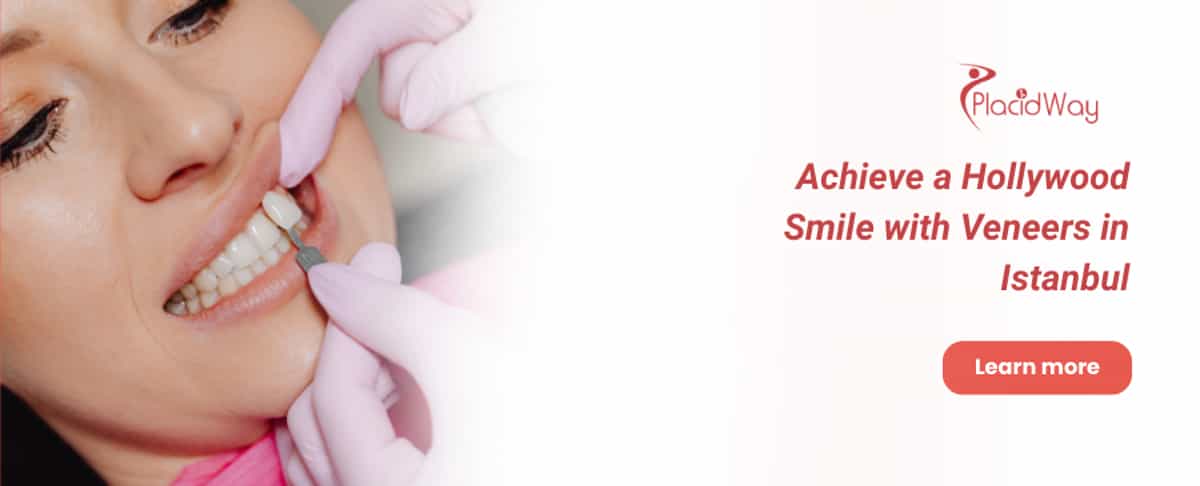 Dental Veneers in Istanbul