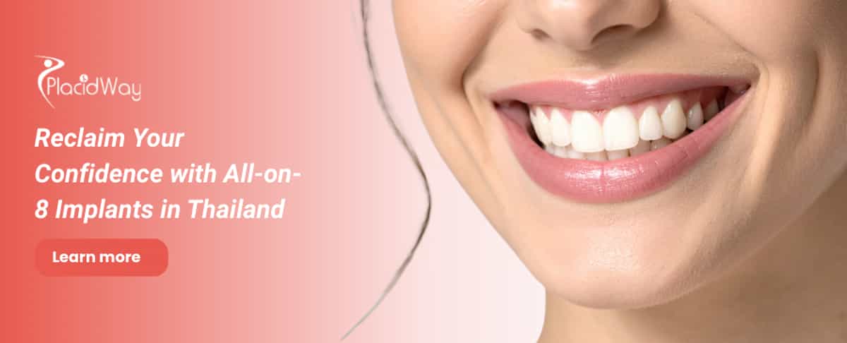 All on 8 Dental Implants in Thailand - Get Dental Implants Abroad 