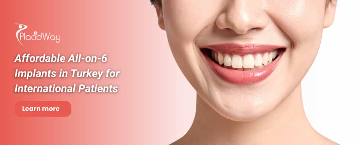 Implantes dentales All on 6 en Turquía