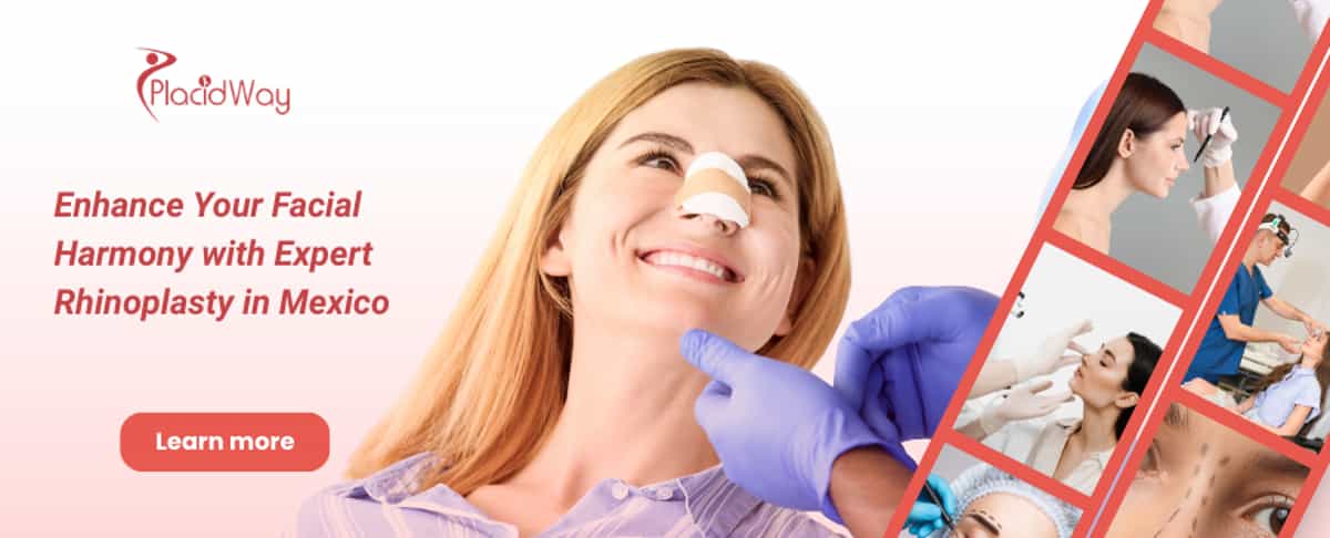 Rinoplastia en Mérida, México