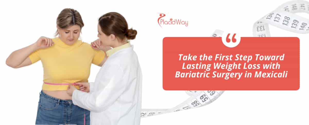 Bariatric Surgery in Mexicali Mexico