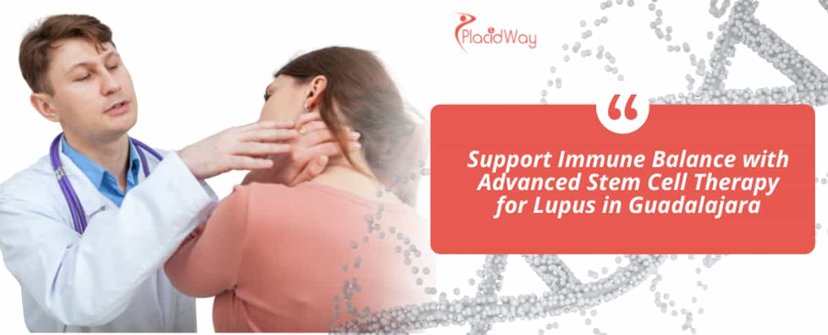 Terapia con células madre para el lupus en Guadalajara, México